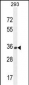 OR10H1 Antibody (C-term)